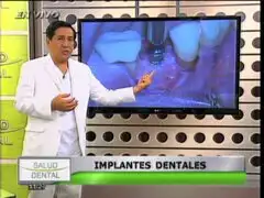 Salud Dental: todo lo que necesitas saber sobre implantes dentales
