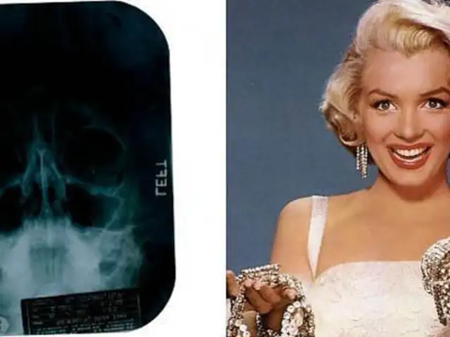 Marilyn Monroe se sometió a una cirugía plástica de nariz y barbilla