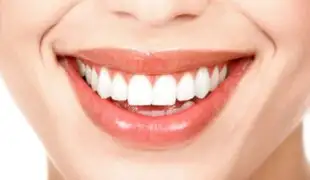 Salud Dental: conoce el adecuado procedimiento de las carillas de porcelana