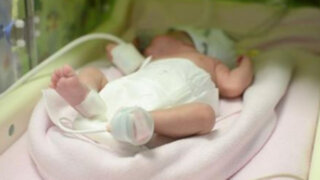 Hungría: mujer con tres meses de muerte cerebral da a luz a bebé