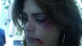Giovanna Valcárcel publicó impactante fotografía con su rostro golpeado