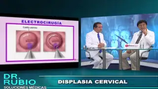 Soluciones Médicas: sepa cómo prevenir y tratar la displasia cervical