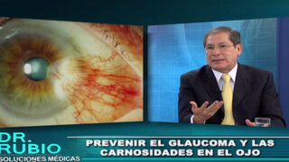 Soluciones Médicas: Sepa cómo prevenir el glaucoma y las carnosidades oculares