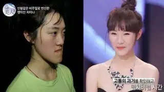 FOTOS: el antes y después de coreanas que participan en reality de cirugía estética
