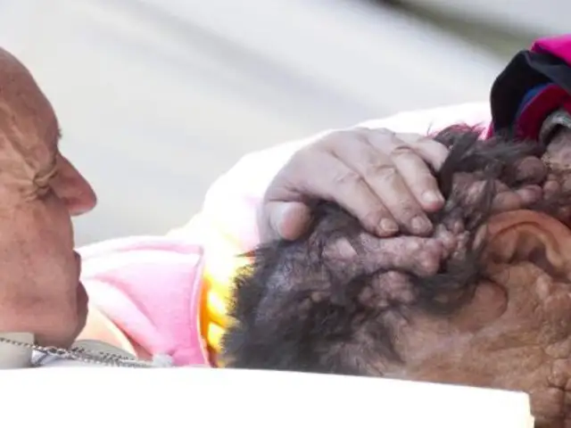 Abrazo del Papa Francisco a hombre con neurofibromatosis conmueve al mundo