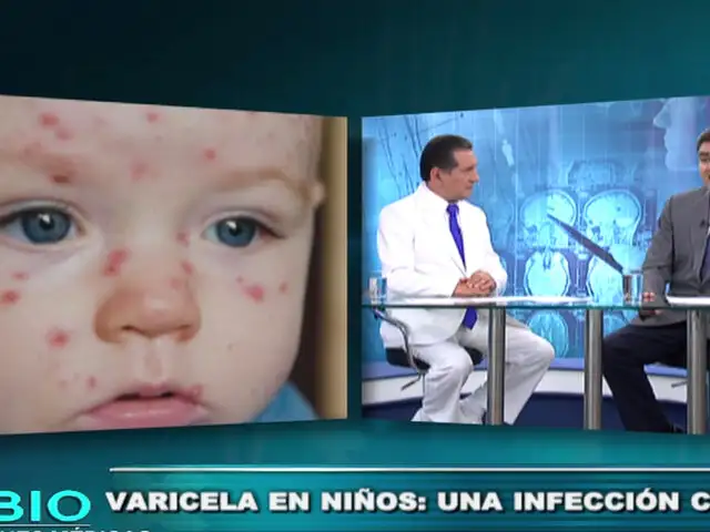 Soluciones Médicas: Sepa los cuidados que requiere un niño con varicela