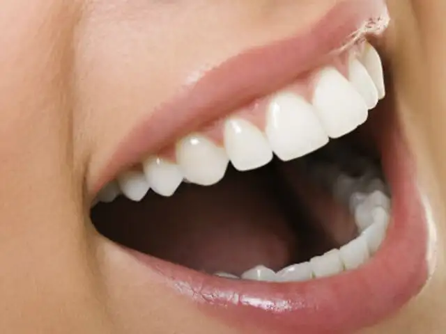 Adiós a los dentistas: científicos descubren bacteria capaz de evitar la caries