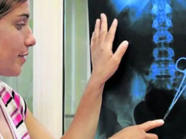 Argentina: médicos olvidan tijeras en el abdomen de una mujer tras cesárea