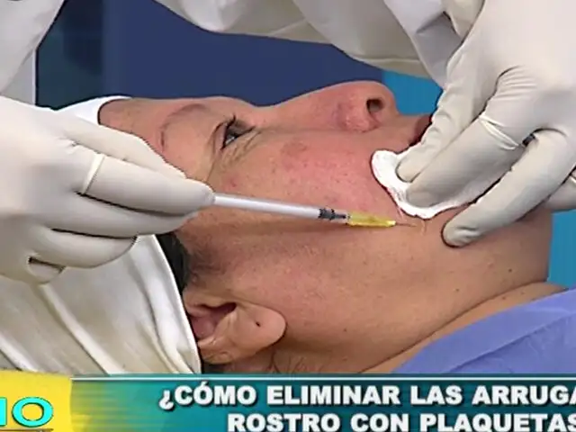 Soluciones Médicas: ¿cómo eliminar las arrugas del rostro con plaquetas?