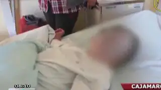 Niño de 7 años quemado tras jugar con pirotécnicos elaborados por su abuelo