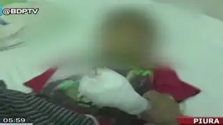 Niño de ocho años perdió dedo por manipular pirotécnico en su casa en Piura