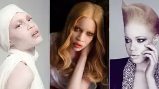 Modelo negra albina emprende lucha contra la discriminación en Sudáfrica