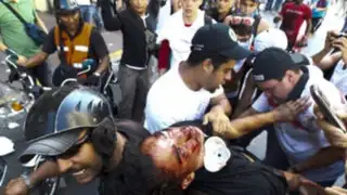 Venezuela: 11muertos y 160 heridos dejan violentos enfrentamientos con policías