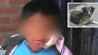 Niño de 8 años casi queda desfigurado tras ataque de perro en Huancayo
