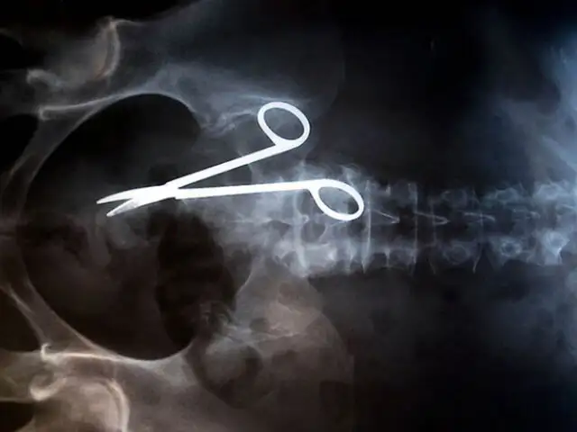 FOTOS: las cosas más insólitas que médicos encuentran gracias a los rayos X