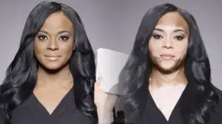VIDEO: cuando maquillaje es el único remedio para camuflar la enfermedad