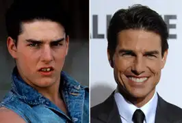 Antes y después: famosos que mejoraron su sonrisa con cirugías dentales