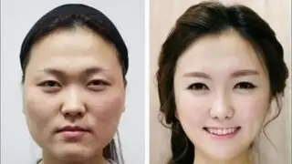 FOTOS: Corea del Sur es el país con la mayor tasa de cirugías estéticas del mundo