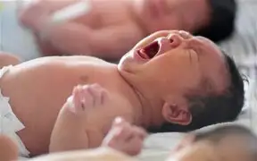 FOTOS: bebé de cinco meses crece con una cola de cinco pulgadas en China