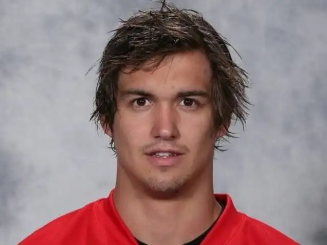 FOTOS: así quedó el rostro de un jugador de hockey que perdió 10 dientes