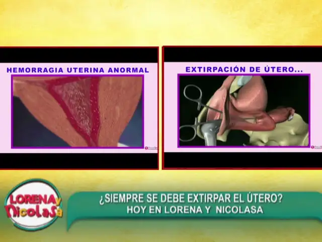 Especialista en ginecología explica cuándo es necesario extirpar el útero