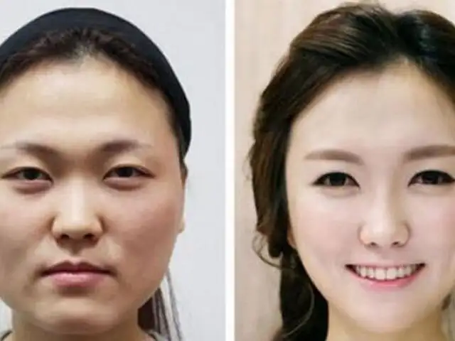 FOTOS: Corea del Sur es el país con la mayor tasa de cirugías estéticas del mundo