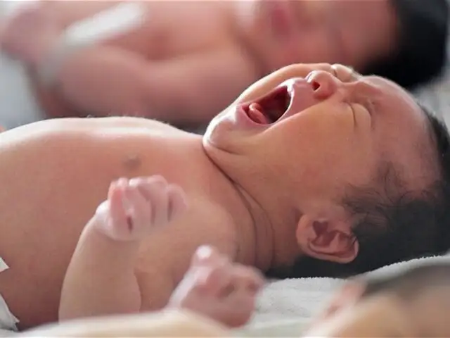 FOTOS: bebé de cinco meses crece con una cola de cinco pulgadas en China