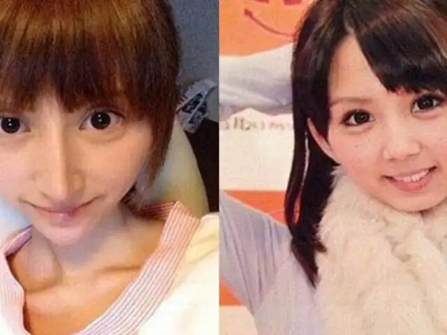 Japón: exceso de cirugías deja con el rostro deforme a actriz porno
