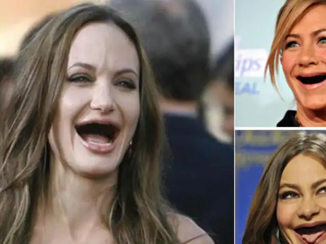 FOTOS: ¿Cómo se verían algunas bellas famosas sin dientes?