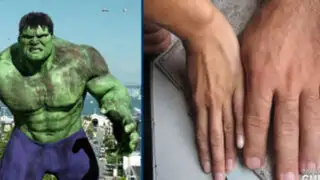 El increíble Hulk existe en la vida real y tiene las manos más grandes del mundo