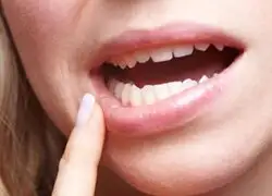 3 de cada 10 limeños sufren serios problemas de salud bucal, según estudio