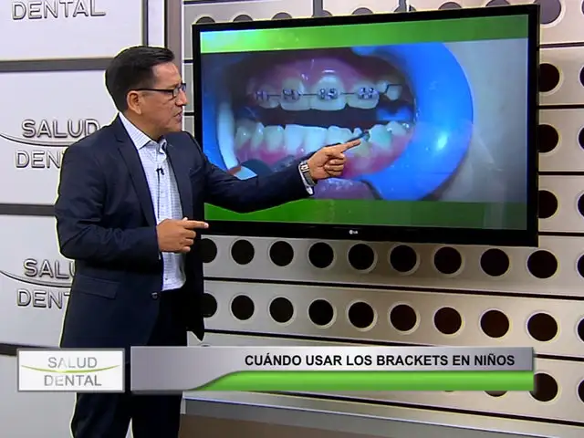 Salud Dental: ¿a qué edad se puede iniciar el uso de brackets en los niños?