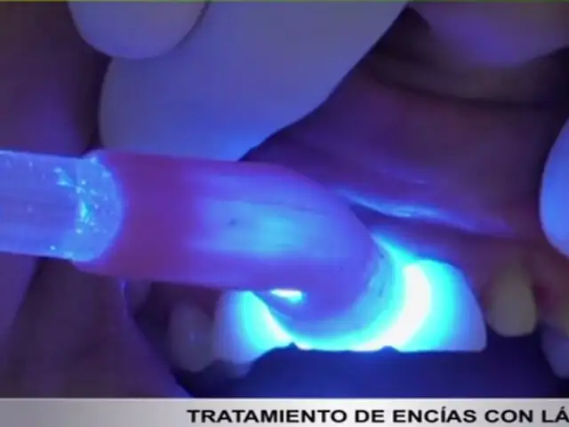 Dígale adiós a la sensibilidad dental con tratamiento de encías con láser