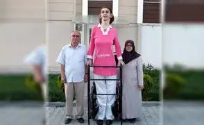 Adolescente turca se convierte en la mujer más alta del mundo
