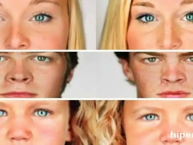 FOTOS: 15 ejemplos de que los gemelos idénticos no son exactamente iguales
