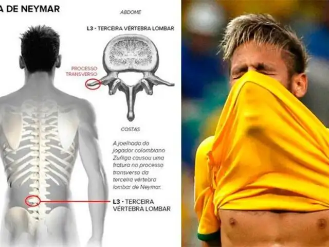 Brasil 2014: infografía grafica lesión que dejó a Neymar fuera del Mundial