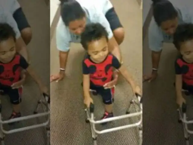 VIDEO: niño de dos años aprende a caminar con pierna ortopédica