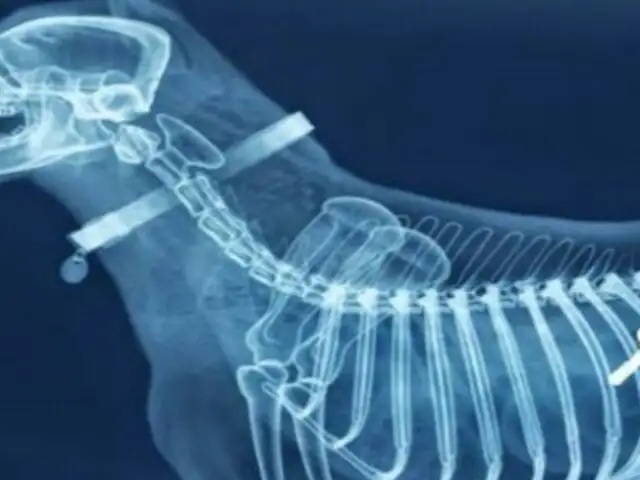 Rayos X aterradores: 21 radiografías que te pondrán los pelos de punta