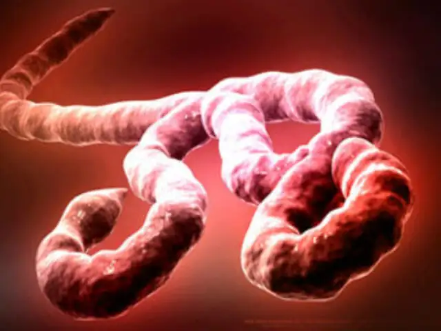Ministerio de Salud declara alerta epidemiológica para prevenir ébola en Perú