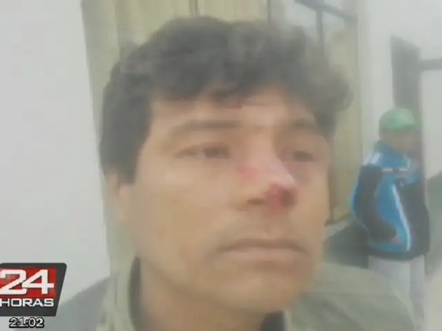Obrero de construcción pierde parte de la nariz durante una gresca en Los Olivos