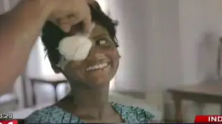 Dos niñas que nacieron ciegas lograron ver gracias a una cirugía gratuita