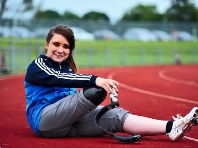 Joven británica pide que le amputen la pierna para correr en los Juegos Paralímpicos