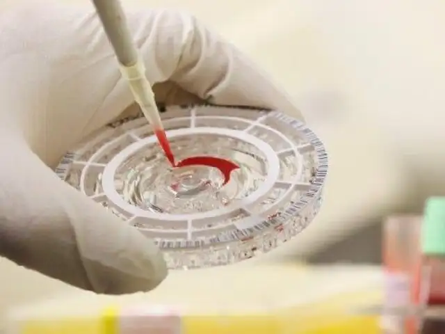 OMS anuncia que vacuna contra el ébola estará lista en marzo de 2015
