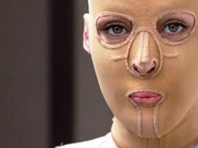 Australia: la mujer "sin rostro" se quita la máscara y sorprende al mundo