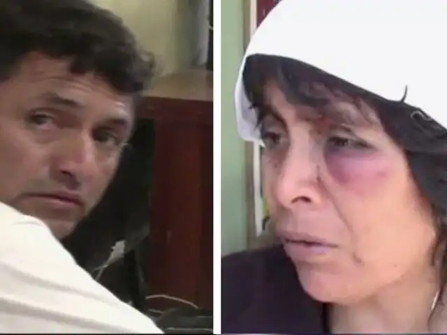 Mujer quedó desfigurada tras ser salvajemente agredida por su esposo