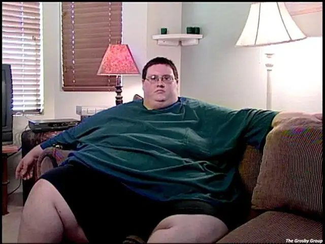 FOTOS: ¿Cómo queda una persona con obesidad mórbida al perder muchos kilos?