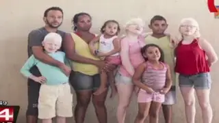 Mujer de raza negra sorprende por tener tres hijos completamente blancos
