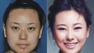 FOTOS: las mujeres chinas y su adicción por las cirugías estéticas extremas