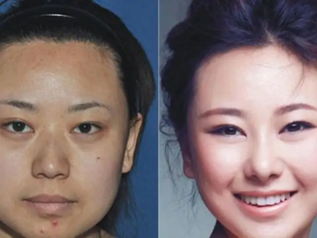 FOTOS: las mujeres chinas y su adicción por las cirugías estéticas extremas