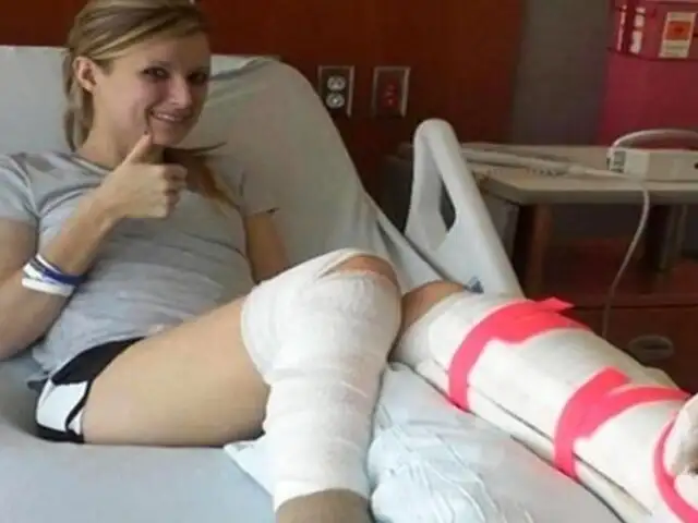 Mujer se despide de su pierna con una carta antes de amputarla